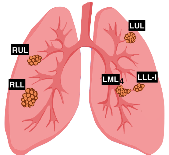 Multi Lesion Target-Id